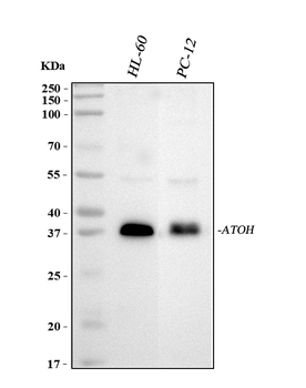 MATH1/HATH1/ATOH1 Rabbit Polyclonal Antibody