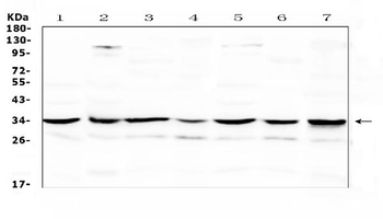 UCP2 Rabbit Polyclonal Antibody