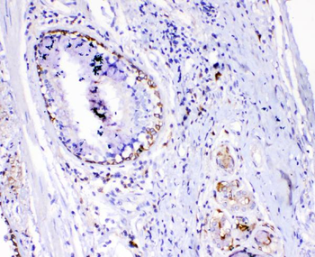 TL1A/TNFSF15 Antibody