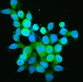 PPID Rabbit Polyclonal Antibody