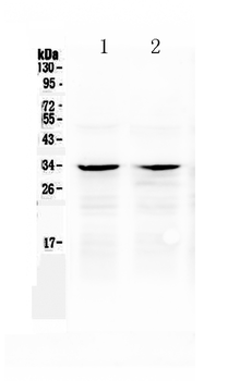 Caspase-6/CASP6 Rabbit Polyclonal Antibody