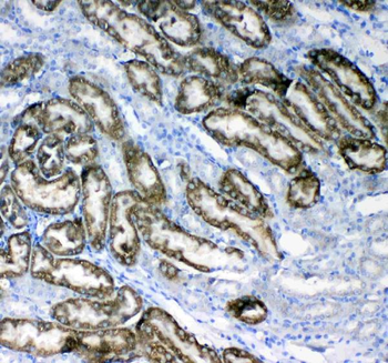 Glycerol kinase/GK Rabbit Polyclonal Antibody