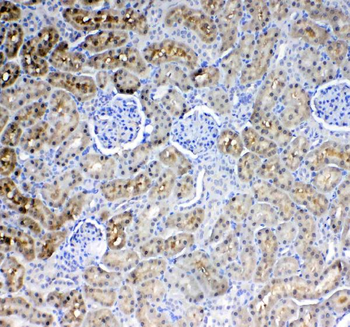 Glycerol kinase/GK Rabbit Polyclonal Antibody