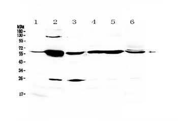 Glycerol kinase/GK Rabbit Polyclonal Antibody