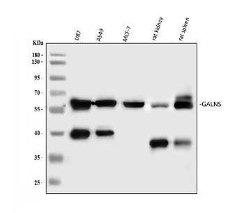 GALNS Antibody