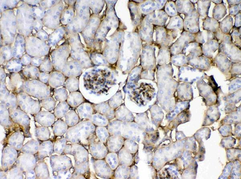 CD105/Eng Rabbit Polyclonal Antibody