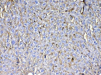 CD105/Eng Rabbit Polyclonal Antibody