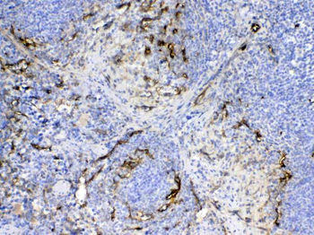 CD105/Eng Rabbit Polyclonal Antibody