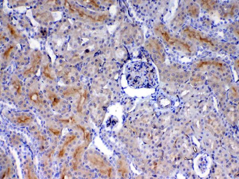 CD105/Eng Rabbit Polyclonal Antibody
