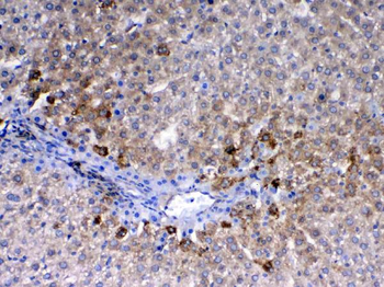 CD105/Eng Rabbit Polyclonal Antibody