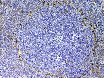 CD105/Eng Rabbit Polyclonal Antibody