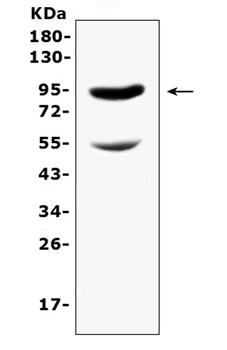 CD105/Eng Rabbit Polyclonal Antibody