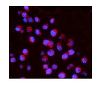 IL15RA Rabbit Polyclonal Antibody