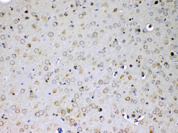 IL15RA Rabbit Polyclonal Antibody