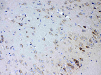 IL15RA Rabbit Polyclonal Antibody