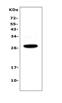IL15RA Rabbit Polyclonal Antibody