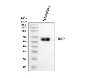 IBSP Rabbit Polyclonal Antibody