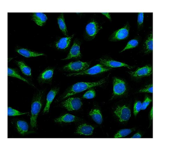 Cyclophilin B/PPIB Rabbit Polyclonal Antibody