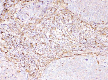 Cyclophilin B/PPIB Rabbit Polyclonal Antibody