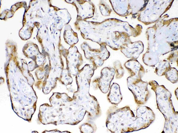 Cyclophilin B/PPIB Rabbit Polyclonal Antibody
