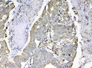 Cyclophilin B/PPIB Rabbit Polyclonal Antibody