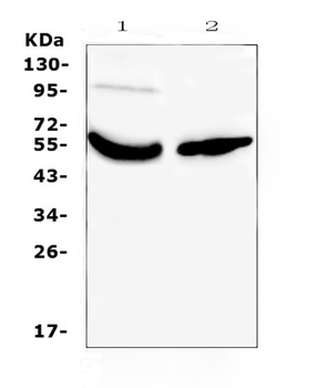 Vitamin D Binding protein/GC Antibody