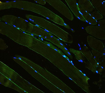 Laminin/Lamc1/Lamc2/Lamc3 Rabbit Polyclonal Antibody
