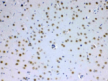 MED15 Antibody