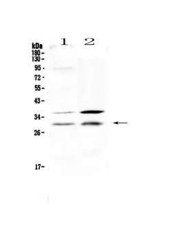 HOXA5 Rabbit Polyclonal Antibody