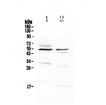 VIP Receptor 1/VIPR1 Rabbit Polyclonal Antibody