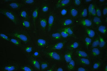 COPE Rabbit Polyclonal Antibody
