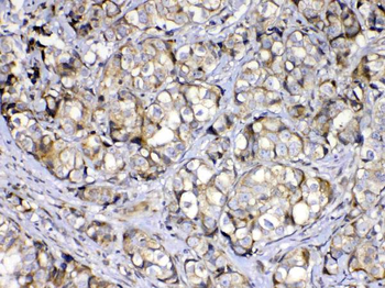 COPE Rabbit Polyclonal Antibody