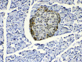 COPE Rabbit Polyclonal Antibody