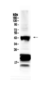 CHX10/VSX2 Rabbit Polyclonal Antibody