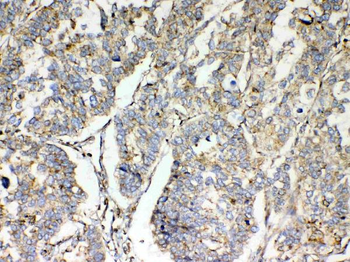 TSPAN12 Rabbit Polyclonal Antibody