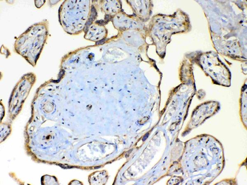 TSPAN12 Rabbit Polyclonal Antibody