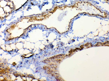 TSPAN12 Rabbit Polyclonal Antibody
