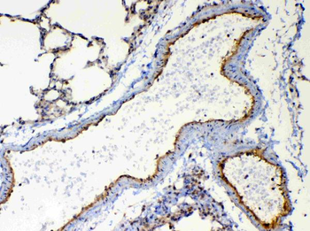 TSPAN12 Rabbit Polyclonal Antibody