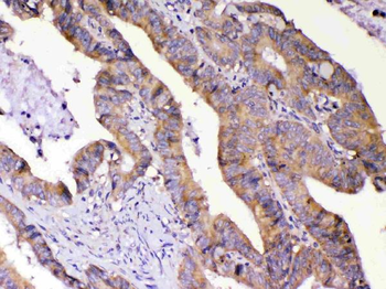 AMD1 Rabbit Polyclonal Antibody