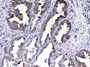 AMD1 Rabbit Polyclonal Antibody