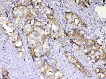 AMD1 Rabbit Polyclonal Antibody