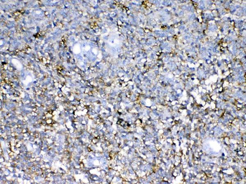 Neurocan/NCAN Rabbit Polyclonal Antibody