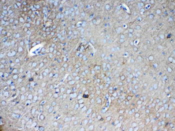 Neurocan/NCAN Rabbit Polyclonal Antibody