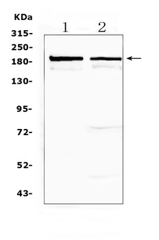 Neurocan/NCAN Rabbit Polyclonal Antibody