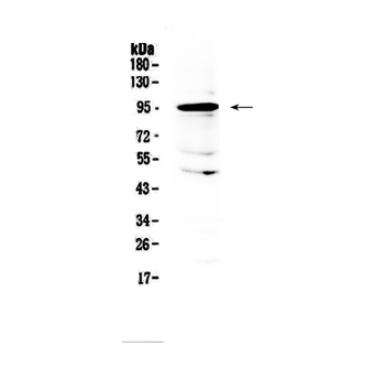 AMOTL2 Rabbit Polyclonal Antibody