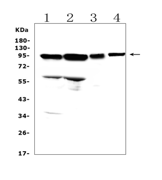 AMOTL2 Rabbit Polyclonal Antibody