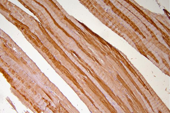 Hsp20/HSPB6 Rabbit Polyclonal Antibody