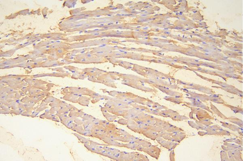 Hsp20/HSPB6 Rabbit Polyclonal Antibody