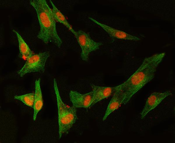 MED8 Rabbit Polyclonal Antibody