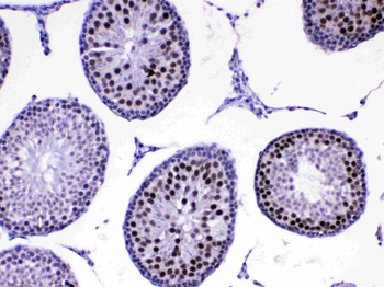 MED8 Rabbit Polyclonal Antibody